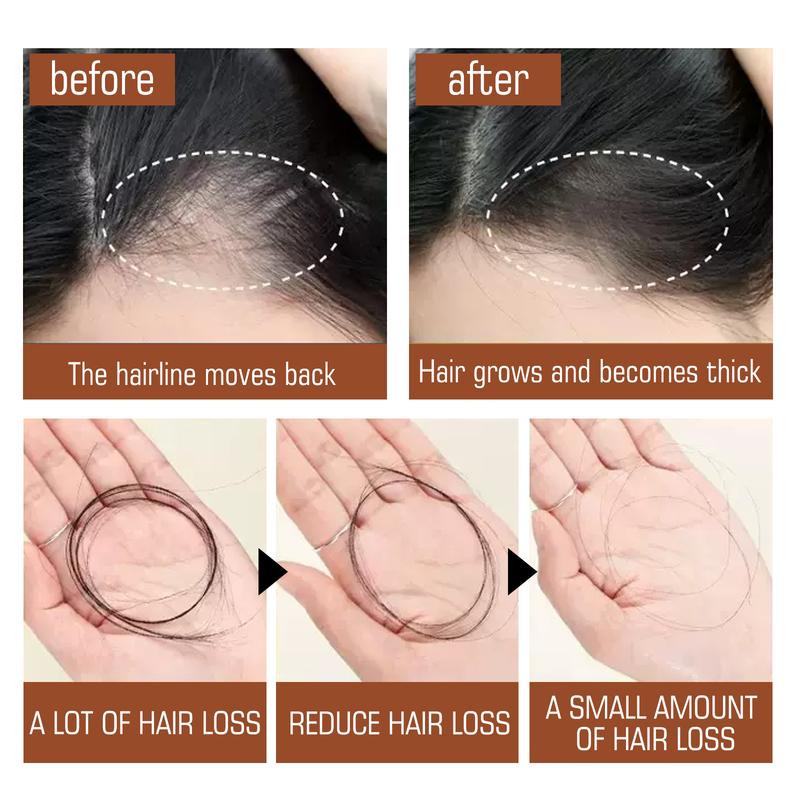Batana Oil from Honduras - Get Fuller, Thicker, Healthier Hair - Great Gifts for Women & Men Conditioner Haircare Silky - Hair Nutrition