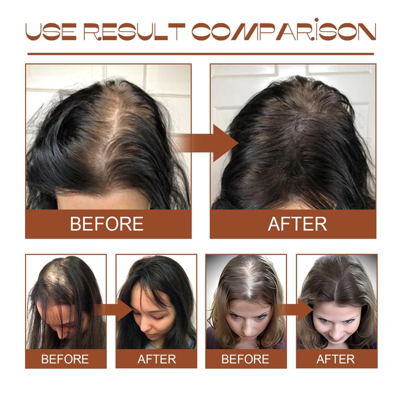 Batana Oil from Honduras - Get Fuller, Thicker, Healthier Hair - Great Gifts for Women & Men Conditioner Haircare Silky - Hair Nutrition