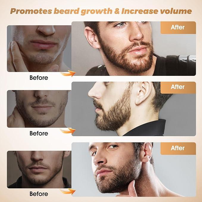 Beard Kit for Hair Growth for Men: Beard Growth Oil for Thicker Fuller Softer Facial Beard Natural Batana Oil Care Beard Growth Kit with Rosemary Oil Castor Oil Biotin