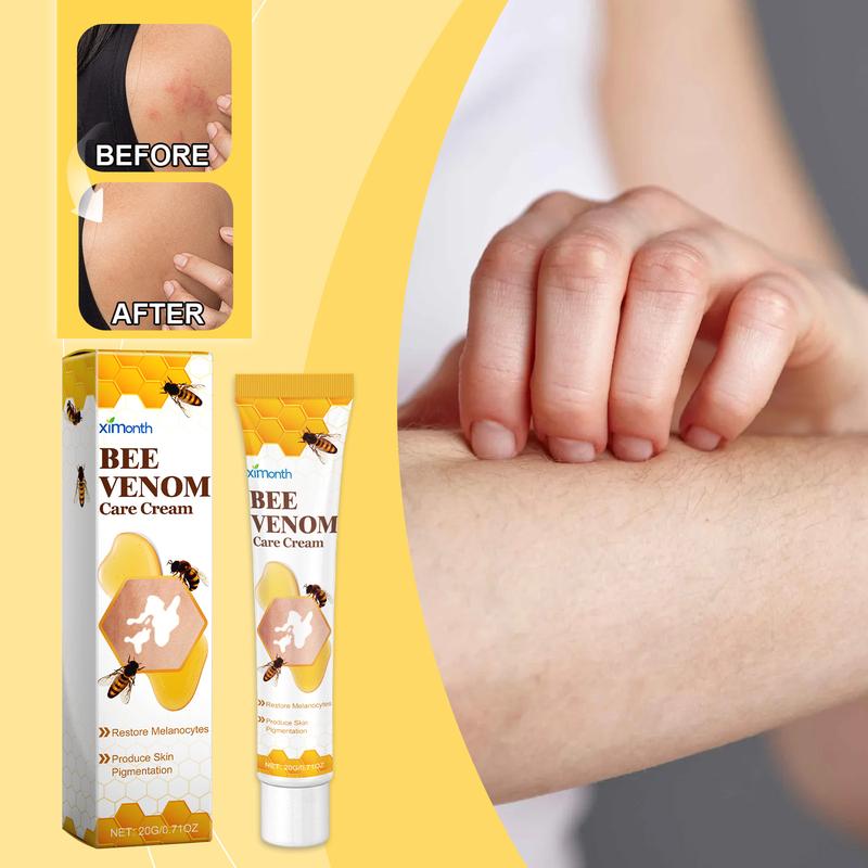 Bee Venom White Spot Treatment Cream Bee Venom Repair Skin Moisturizing Skin Care Topical Application Treatment Cream